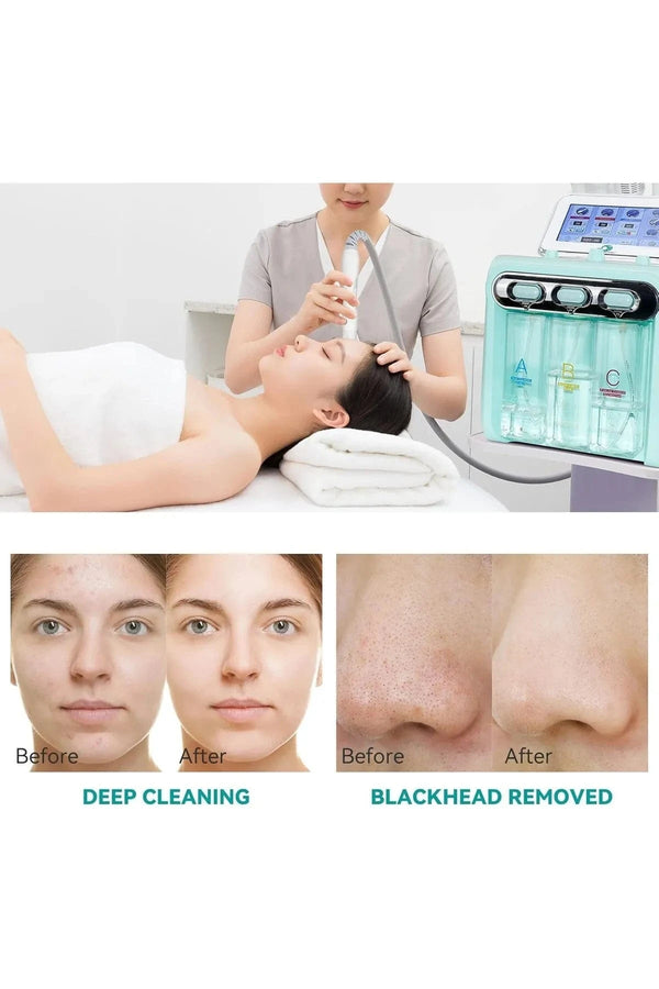 Globalstar 7-in-1 Hydra Facial Machine – Professional Skin Rejuvenation & Blackhead Removal Beauty Device, Green Metal