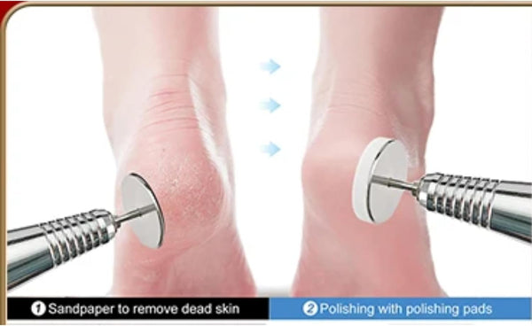 Globalstar Professional Pedicure Kit: 100 Sandpaper Discs (#150 Grit) & 3/32" Shank Metal Drill Bit for Effective Callus Removal