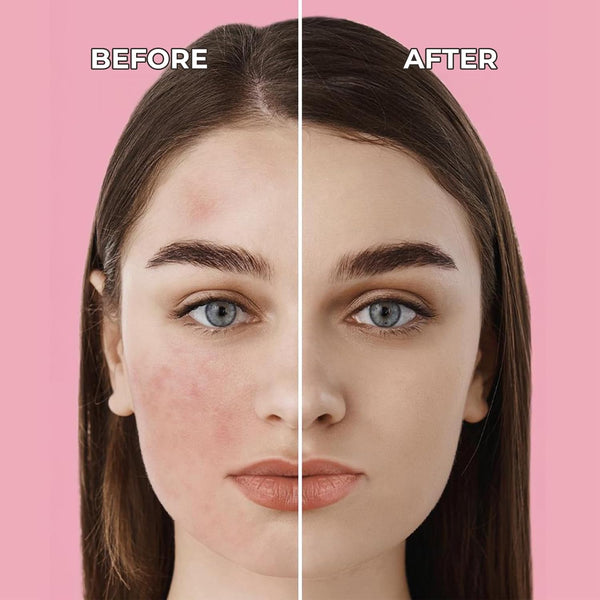 Sinoz Pink Touch Color Correcting Treatment SPF 50+ – Redness Reducer & Skin Tone Equalizer, 50ml