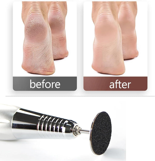 Globalstar Professional Pedicure Kit: 100 Sandpaper Discs (#150 Grit) & 3/32" Shank Metal Drill Bit for Effective Callus Removal