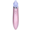 Globalstar Blackheads Vacuum Removal - XN8030 - Awarid UAE