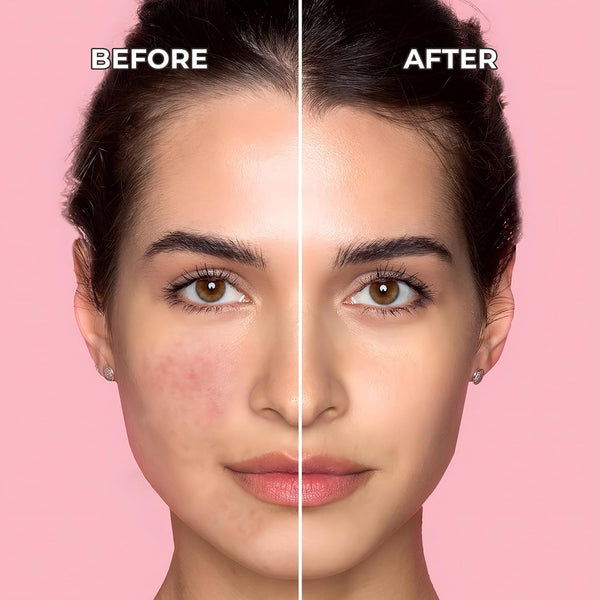 Sinoz Pure Cica Tiger Grass Correcting Cream SPF50+ – Color-Changing, Redness Repair & UV Protection, 50ml