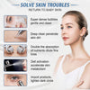 Globalstar 14-in-1 Hydrafacial Machine – Professional Hydrogen Oxygen Facial System with LCD Display & Vacuum Acne Removal